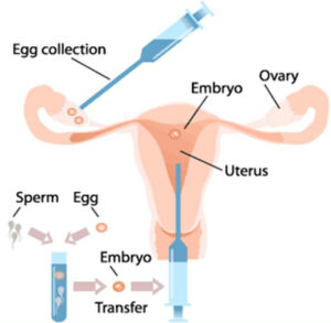 Best Female infertility treatment in Bangalore
