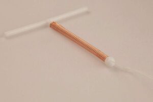 Copper T/mirena IUD