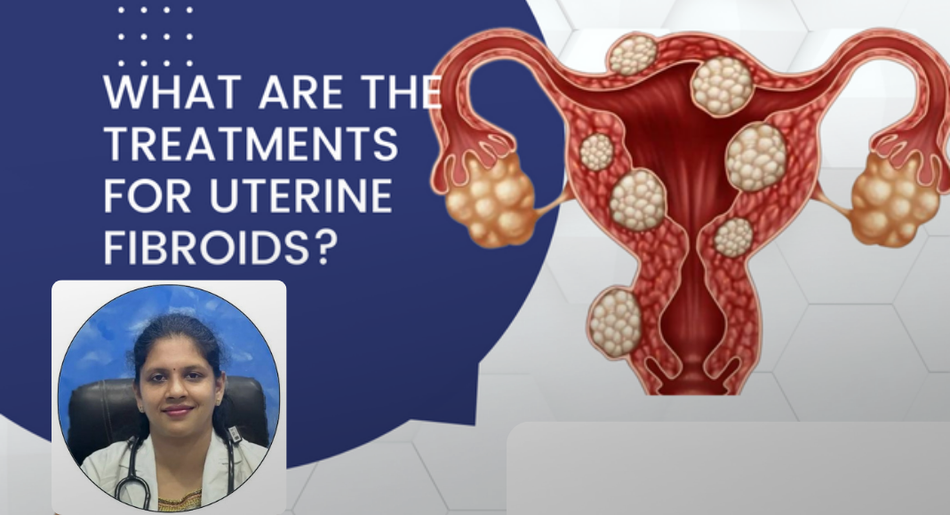 Uterine Fibroids Treatment in Bangalore